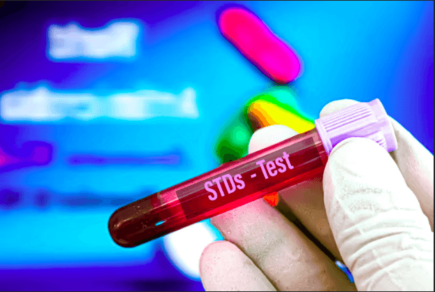 Where to Get Confidential STD Testing in Houston