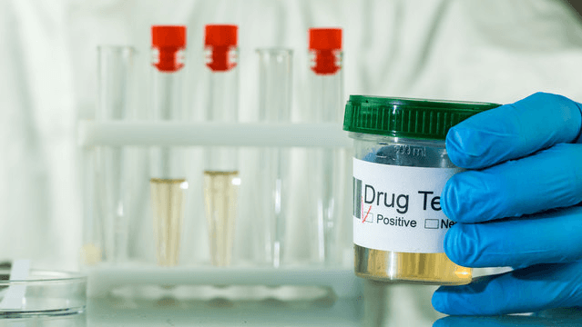 Drug Testing in Houston: Types of Drug Screens for Employment and Personal Needs