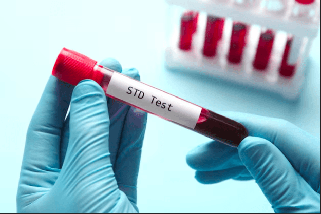 How Fast Can You Get STD Test Results in Houston?