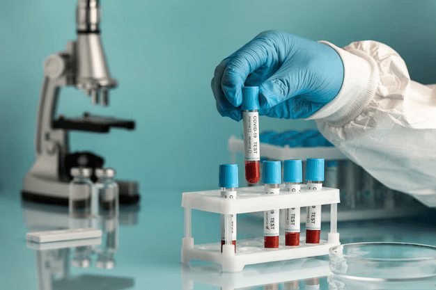 Lab Testing in Katy: Everything You Should Know Before Booking Your Blood Test