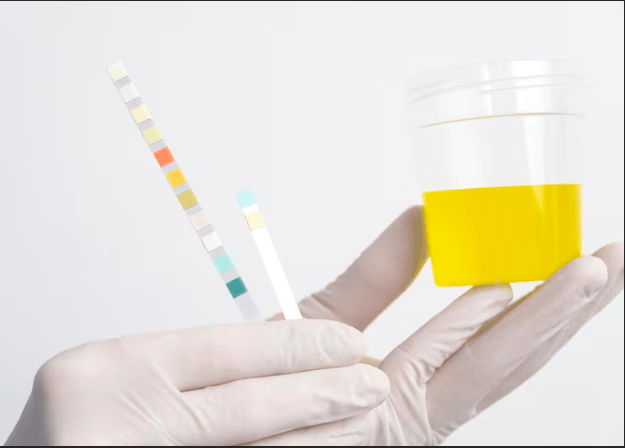 Why Choose Hair Drug Testing Over Urine in Houston?